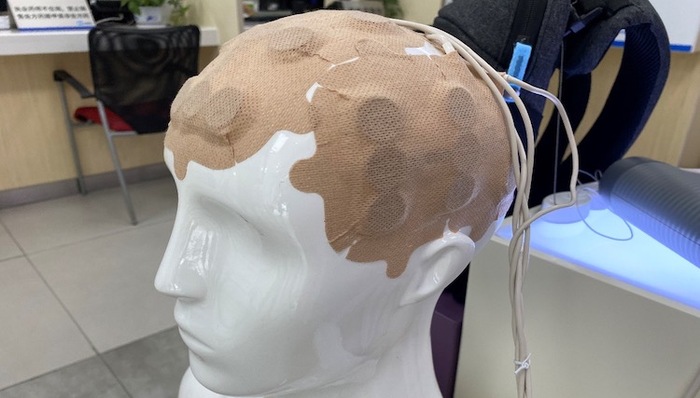 肿瘤电场疗法正式上市，癌症治疗迎来第四种手段