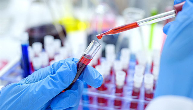 地方新闻精选 | 河北三河查处多起违规开展核酸检测案件 四川冕宁暴雨致14人遇难8人失联