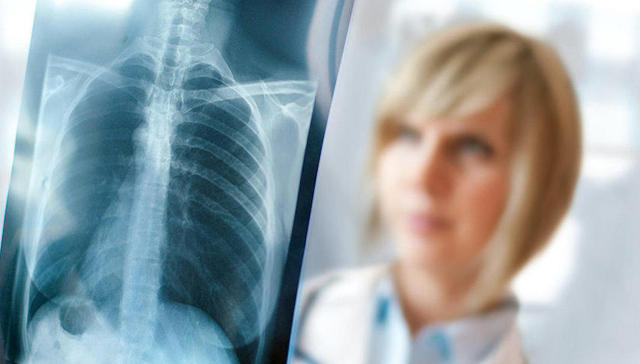 中国驻哈萨克斯坦大使馆提醒防范不明肺炎：死亡率远高于新冠