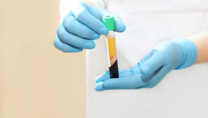 “新冠血浆疗法”紧急授权被FDA搁置