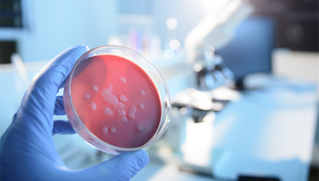 传染病防治法修订征求意见，重点突出不明原因聚集性疾病防控