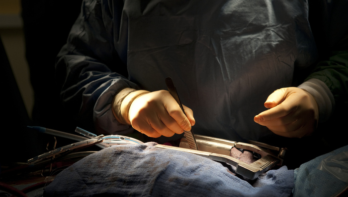 冠脉支架也要带量采购了，价格或暴降85%以上