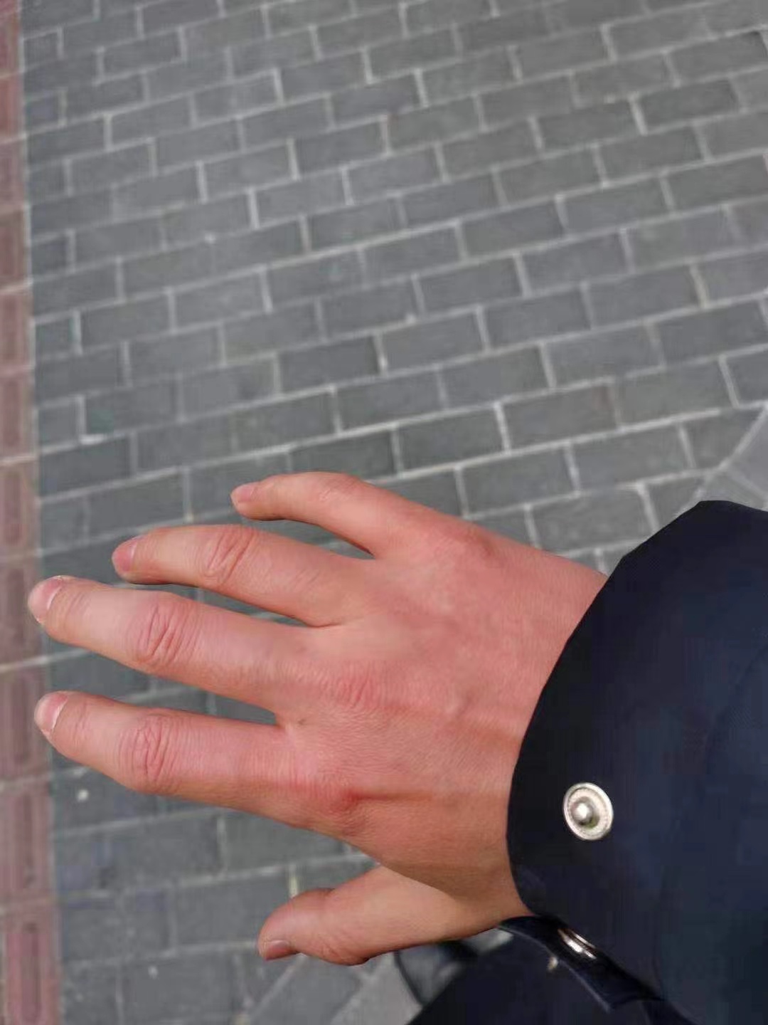 1月7日，黄俊处理完一次交通事故后，拍下自己被冻僵的手。