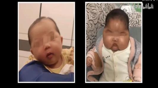 漳州卫健部门：“大头娃娃”涉事抑菌霜共出货1200瓶，正召回检测