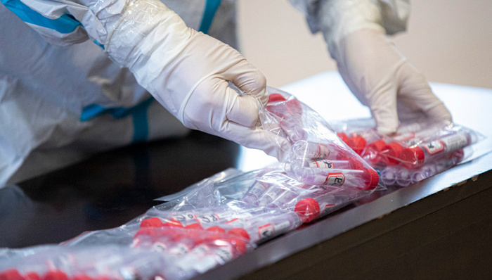 核酸检测,上市公司业绩圣湘生物,东方生物,之江生物,明德生物