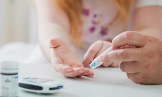 血糖,医疗,美容