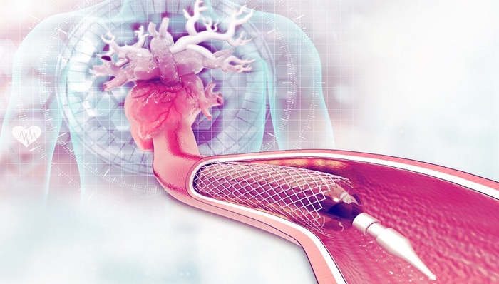 百心安生物,港股IPO,支架,君联资本,正心谷资本,奥博资本,