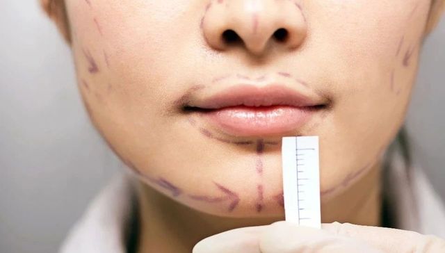 医疗美容,投资,消费