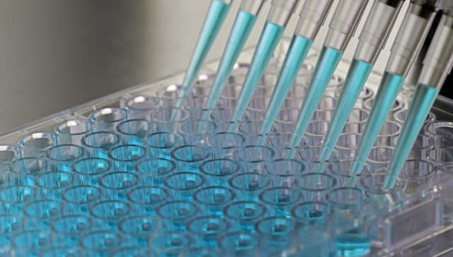 新冠检测.试剂,业绩暴涨,股价,科创板