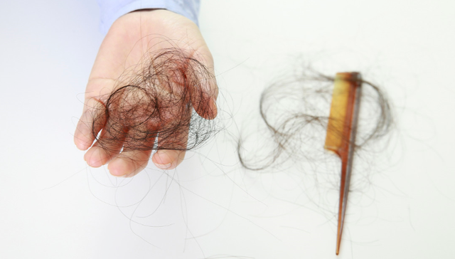 植发机构,雍禾医疗,利润率低,颜值经济