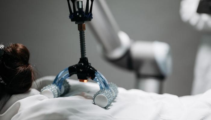 手术机器人,技术创新,融资补血,亏损