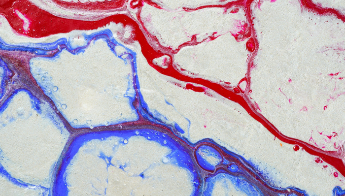 医疗器械,外周介入