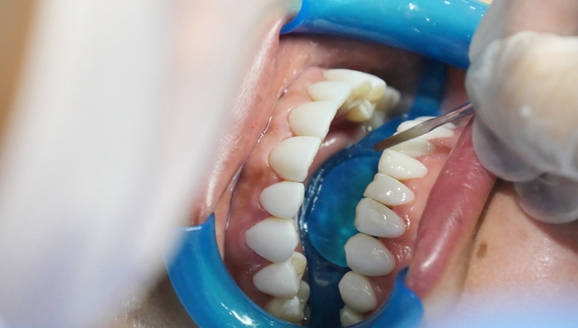 被口腔科医生抵制的美牙专委会，刚成立 1 个月就摘牌了