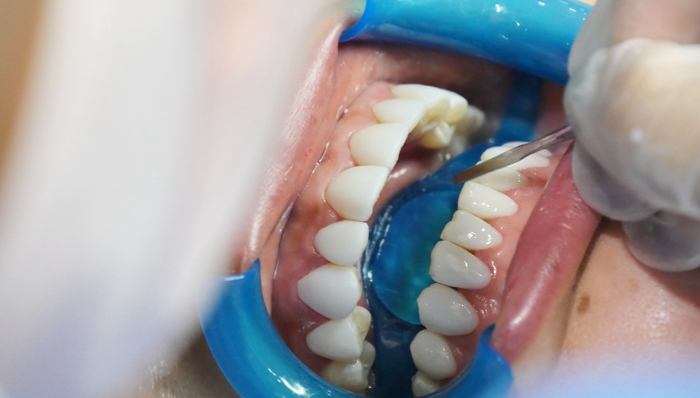 被口腔科医生抵制的美牙专委会，刚成立 1 个月就摘牌了