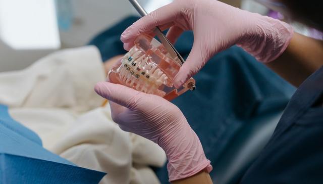 时代天使,隐形正畸