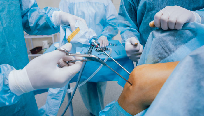 骨科,史赛克,进口代替