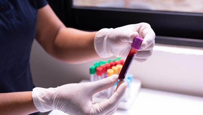 血液制品,炒股,亏损