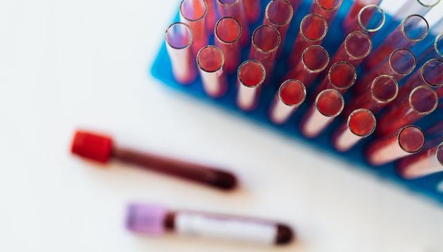 血管介入,医疗技术