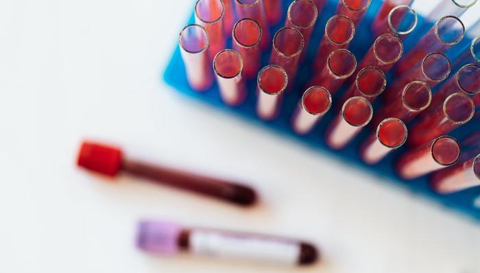 血管介入,医疗技术