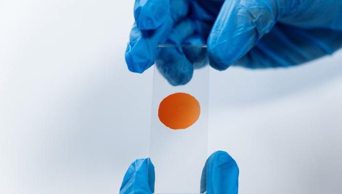 和瑞基因,收购,技术优势