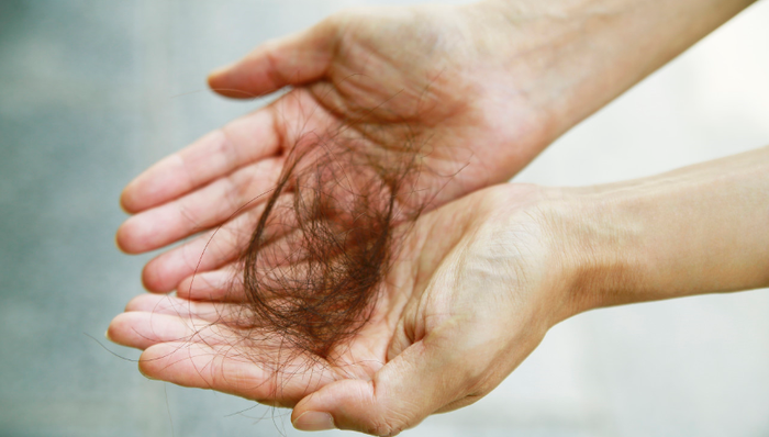植发机构,脱发焦虑,雍禾植发