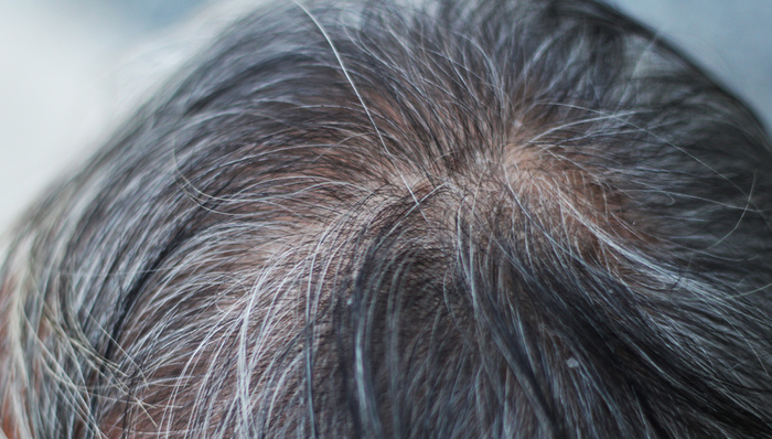 雍禾医疗,植发,营销投入