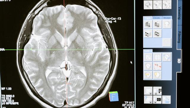 康复行业,市场规模