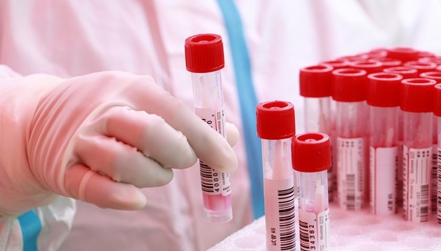 地方新闻精选 | 厦门春节期间为群众提供免费核酸检测 山东3月进入强制垃圾分类时代