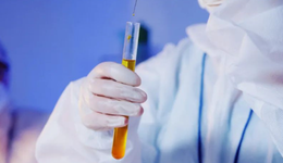 重阳投资坚守四年，800亿新和成扩张遭“阻击”