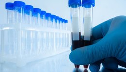 IPO雷达｜新冠检测业务突然下滑，财务内控不规范，硕华生命转战创业板隐患重重