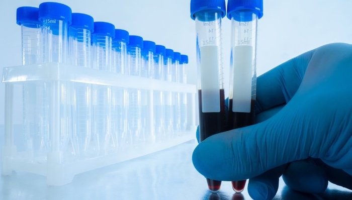 硕华生命，新冠检测，体外诊断，家族控股，环保处罚