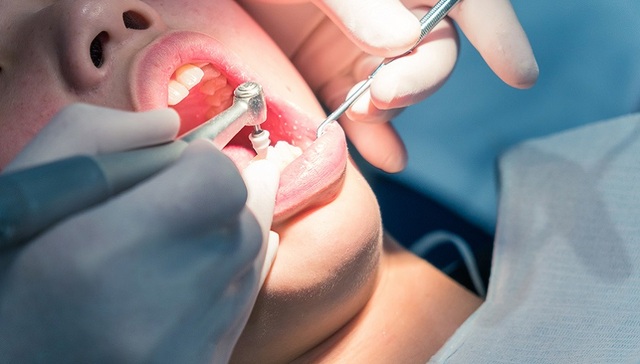 当口腔连锁们遇上集采，“金口银牙”的信仰还在吗？