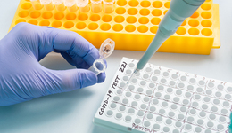 上海制造！全自動(dòng)核酸檢測(cè)平臺(tái)獲批上市，日檢測(cè)量最高可達(dá)9萬(wàn)人次