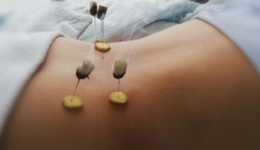 这届“怕死”的年轻人，“疫后”正在拼命“养生”