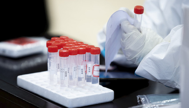 上海,抗疫,每日,问答,核酸检测,通行证,复工证,新冠疫苗,接种,儿童,感染者,消毒,出舱