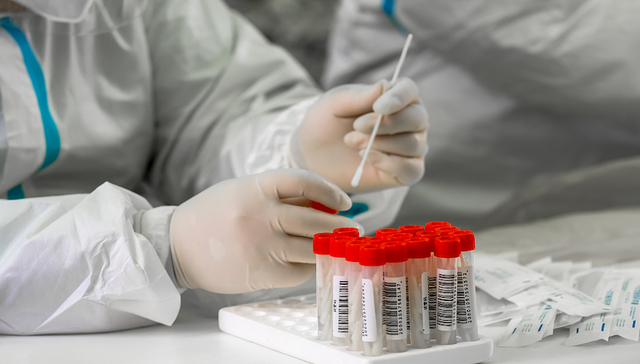 财说｜常态化核酸检测，哪些上市公司业绩受影响？