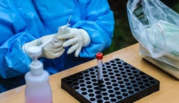 上海市公衛(wèi)中心專家沈銀忠：堅(jiān)持“動(dòng)態(tài)清零”，保護(hù)的是包括高危人群在內(nèi)的所有人