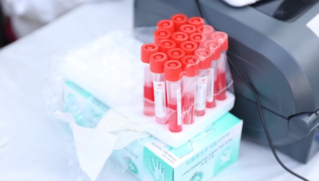 上海普陀,流动核酸检测车,早餐工程,早餐车,疫情