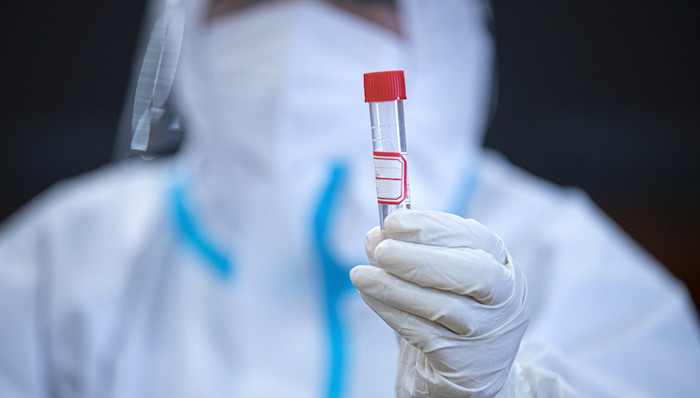 上海,疫情,核酸检测,中科润达,上海市卫健委,发布会