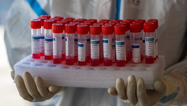 地方新闻精选 | 合肥将每5天做1次免费核酸检测 湘江漓江将出现超警戒洪水