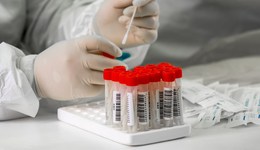 地方新聞精選 | 廣東核酸單檢降至18元/人 北京景區(qū)嚴查48小時核酸證明