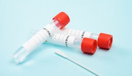 國家醫(yī)保局：常態(tài)化核酸檢測費用由各地政府承擔