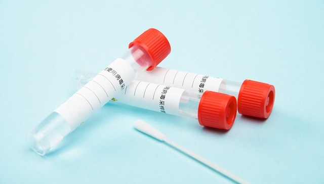 国家医保局：常态化核酸检测费用由各地政府承担