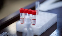 直通部委 | 常態(tài)化核酸檢測費用將由各地政府承擔 全國交通過度管控問題已動態(tài)清零