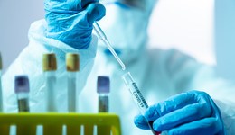 衛(wèi)健委：三類城市應建15分鐘核酸采樣圈，低風險地區(qū)沒必要頻繁檢測