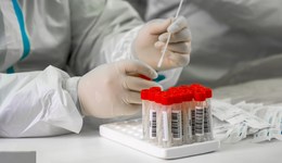 加強核酸采樣質(zhì)量控制，國務院聯(lián)防聯(lián)控機制印發(fā)采樣人員培訓方案