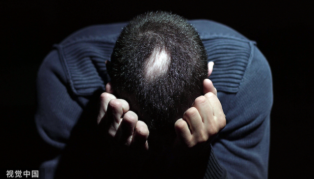 首个斑秃口服药“秃如其来”，可恢复90%头发生长