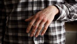 IPO雷達(dá)｜無(wú)一款產(chǎn)品上市，智翔金泰擬“狂圈”40億，智飛生物蔣仁生“養(yǎng)不起”了？