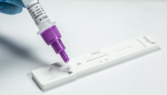 中翰生物，体外诊断，新冠抗原检测