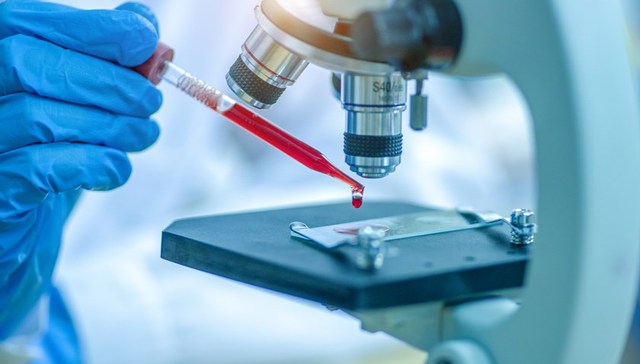 直通部委 | 公安部公布5000余个免费采血点信息 全国一个月减征车购税71亿元